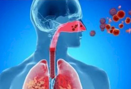 Vírus respiratórios tendem a aumentar no Espírito Santo, aponta Fiocruz